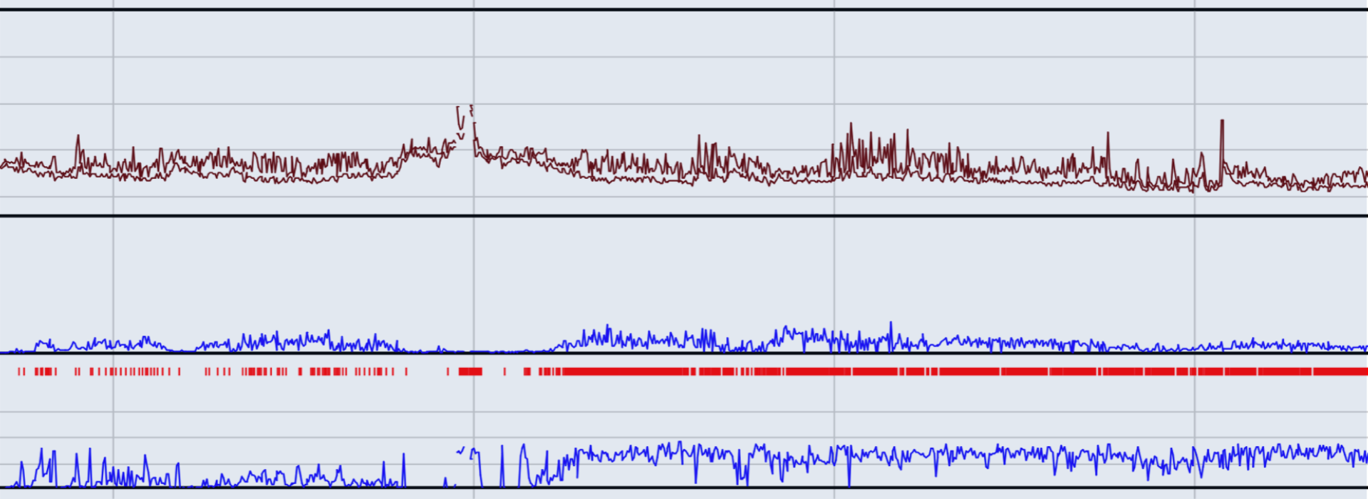 A section of a sleep study trace: airflow, respiratory effort and oxygen saturation plotted across part of a night, with repeated events marked in red